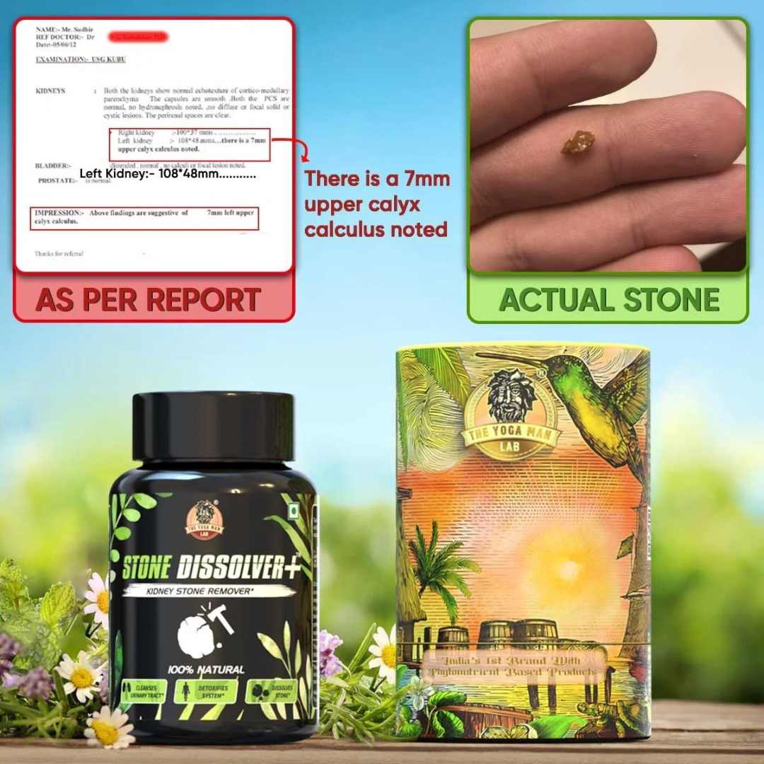 Stone Dissolver™ x 20 Cápsulas – Riñones Limpios y Sin Dolor 💧