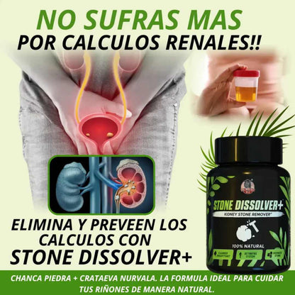 Stone Dissolver™ x 20 Cápsulas – Riñones Limpios y Sin Dolor 💧