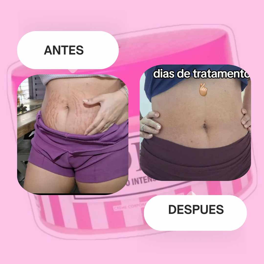 Crema Adeus 5 en 1 x 300g – Piel Firme y Sin Imperfecciones 💖