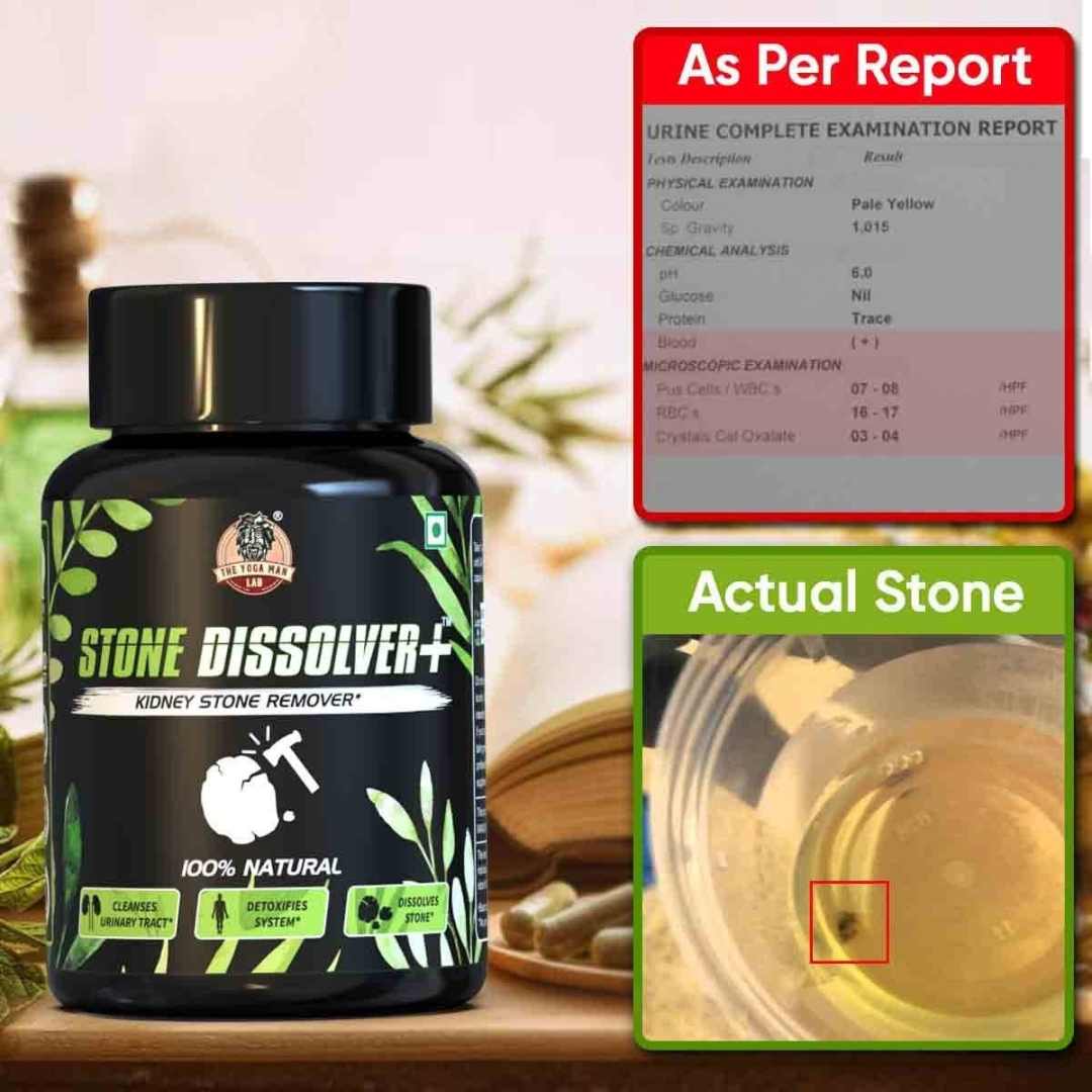 Stone Dissolver™ x 20 Cápsulas – Riñones Limpios y Sin Dolor 💧